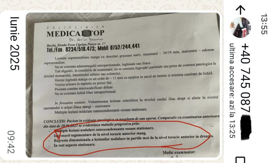 regresie cancer san silviu brinzoi