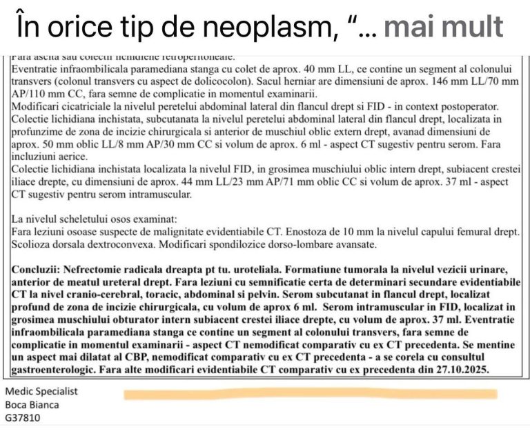 neoplasm stationar silviu brinzoi