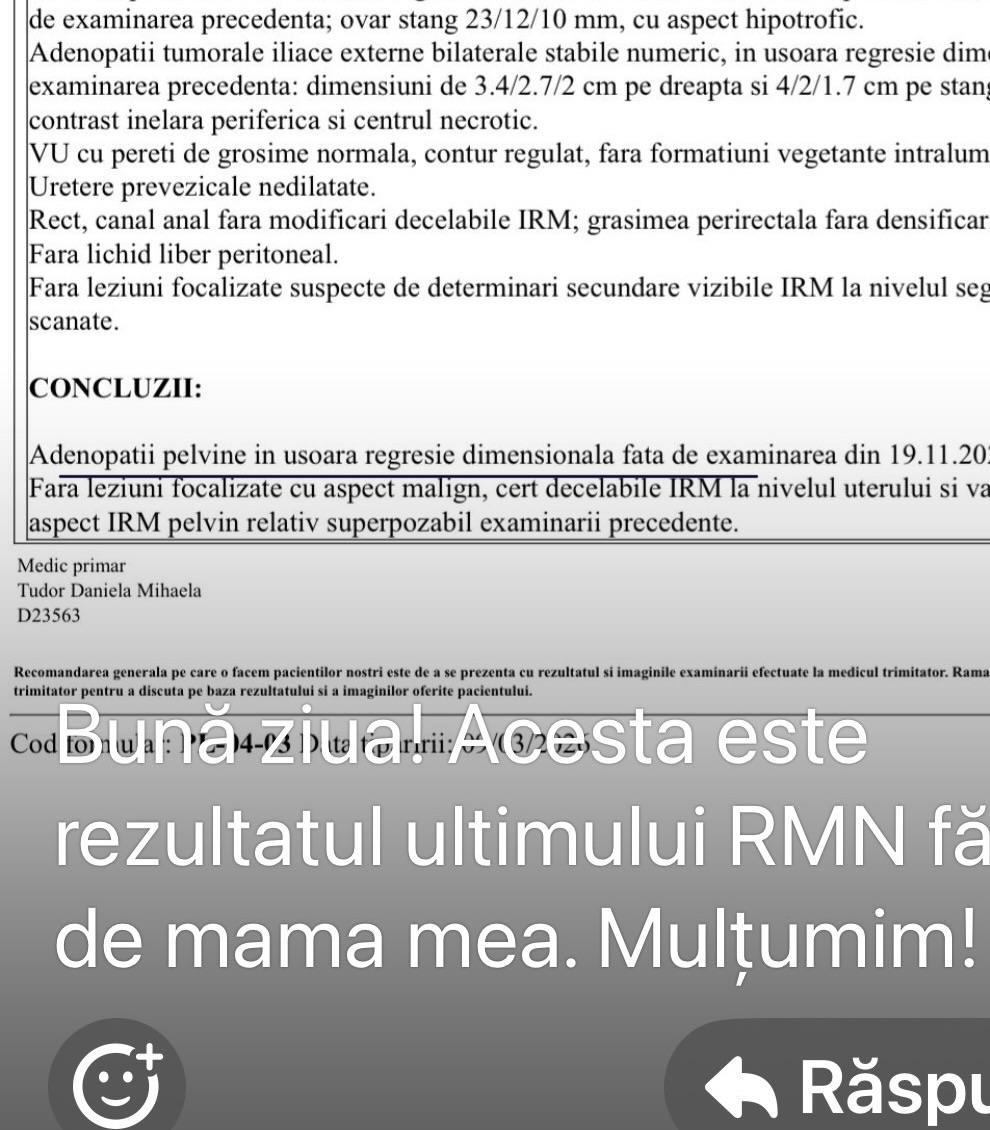 regresie silviu brinzoi