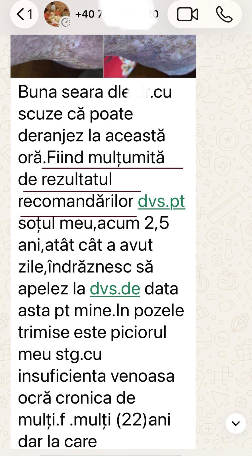 picior diabetic silviu brinzoi