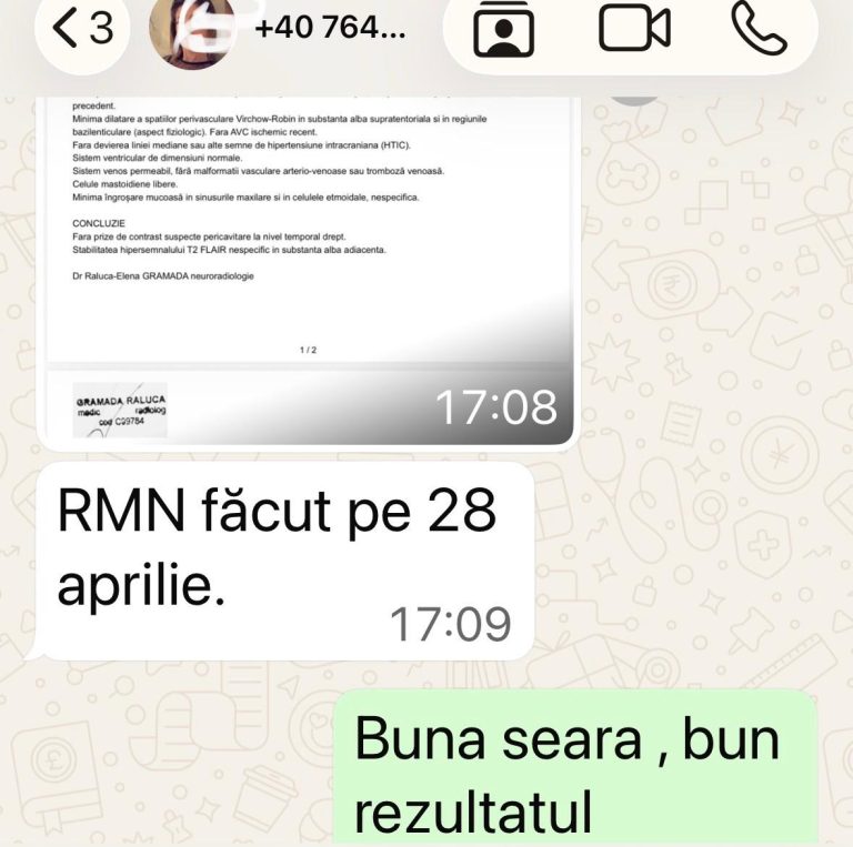 Glioblastom stationar silviu brinzoi